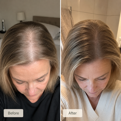 Katrine H., 51 | 5 months on the routine | verified customer