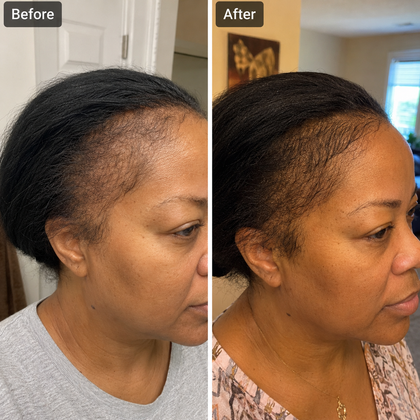Hannah V., 44 | 3 months on the routine | Verified customer